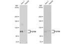 FGFR4 Antibody in Western Blot (WB)