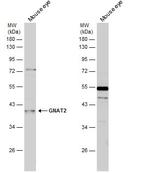 GNAT2 Antibody in Western Blot (WB)