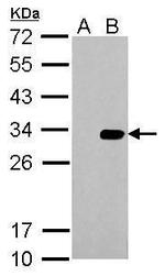 HSV Tag Polyclonal Antibody