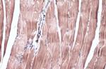 IRS2 Polyclonal Antibody