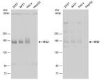 IRS2 Antibody in Western Blot (WB)