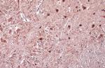 ISL2 Polyclonal Antibody