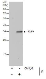 KLF9 Antibody in Immunoprecipitation (IP)
