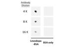 Levodopa Antibody in Dot Blot (DB)