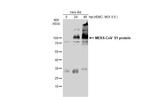 MERS Coronavirus Spike Protein S1 Antibody in Western Blot (WB)