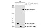 MERS Coronavirus Spike Protein S1 Antibody in Western Blot (WB)