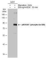Phospho-RSK1 (Ser380) Antibody in Western Blot (WB)