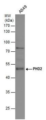 PHD2 Antibody in Western Blot (WB)