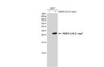 SARS-CoV-2 NSP1 Antibody in Western Blot (WB)