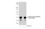 SARS/SARS-CoV-2 Nucleocapsid Antibody in Immunoprecipitation (IP)