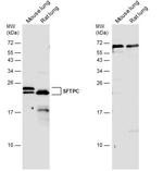 SFTPC Polyclonal Antibody