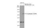 Phospho-SRC (Tyr416) Antibody in Western Blot (WB)