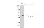 Strep Tag Polyclonal Antibody