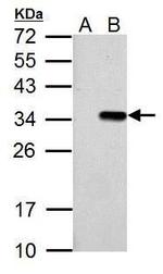 T7 Tag Polyclonal Antibody