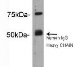 Complement C4b Polyclonal Antibody