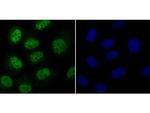 Cdc25C Polyclonal Antibody