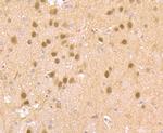Cdc25C Antibody in Immunohistochemistry (Paraffin) (IHC (P))
