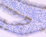 Cdc25C Antibody in Immunohistochemistry (Paraffin) (IHC (P))