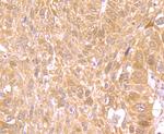 Nrf2 Antibody in Immunohistochemistry (Paraffin) (IHC (P))