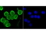 Fyn Antibody in Immunocytochemistry (ICC/IF)