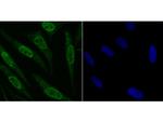 Fyn Polyclonal Antibody
