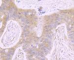ATP Citrate Lyase Antibody in Immunohistochemistry (Paraffin) (IHC (P))