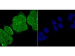 RARA Antibody in Immunocytochemistry (ICC/IF)