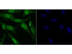 RARA Polyclonal Antibody