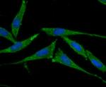 SMAD4 Polyclonal Antibody