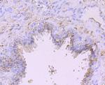 ADAM10 Polyclonal Antibody