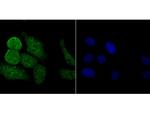 PKC beta Polyclonal Antibody