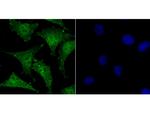 SATB1 Polyclonal Antibody