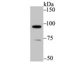 SATB1 Antibody in Western Blot (WB)