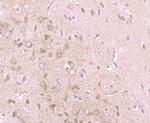 IFN alpha Antibody in Immunohistochemistry (Paraffin) (IHC (P))