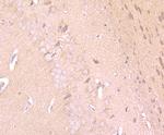 IFN alpha Antibody in Immunohistochemistry (Paraffin) (IHC (P))