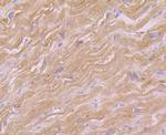 GOT1 Polyclonal Antibody