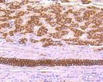TROP2 Antibody in Immunohistochemistry (Paraffin) (IHC (P))