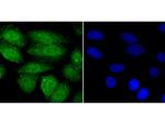 SHP-1 Polyclonal Antibody