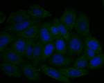UQCRC2 Polyclonal Antibody