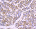SDHB Antibody in Immunohistochemistry (Paraffin) (IHC (P))