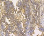 Galectin 3 Antibody in Immunohistochemistry (Paraffin) (IHC (P))