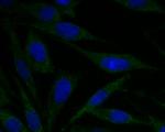 ACADM Polyclonal Antibody