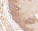 GSDMD Antibody in Immunohistochemistry (Paraffin) (IHC (P))