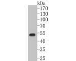 GABRD Polyclonal Antibody