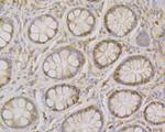 MCM7 Antibody in Immunohistochemistry (Paraffin) (IHC (P))