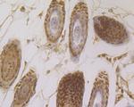 MCM7 Antibody in Immunohistochemistry (Paraffin) (IHC (P))