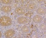 Galectin 4 Antibody in Immunohistochemistry (Paraffin) (IHC (P))