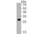 TREM2 Antibody in Western Blot (WB)