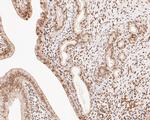 LMO2 Antibody in Immunohistochemistry (Paraffin) (IHC (P))