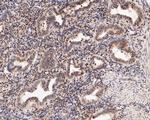 LMO2 Antibody in Immunohistochemistry (Paraffin) (IHC (P))
